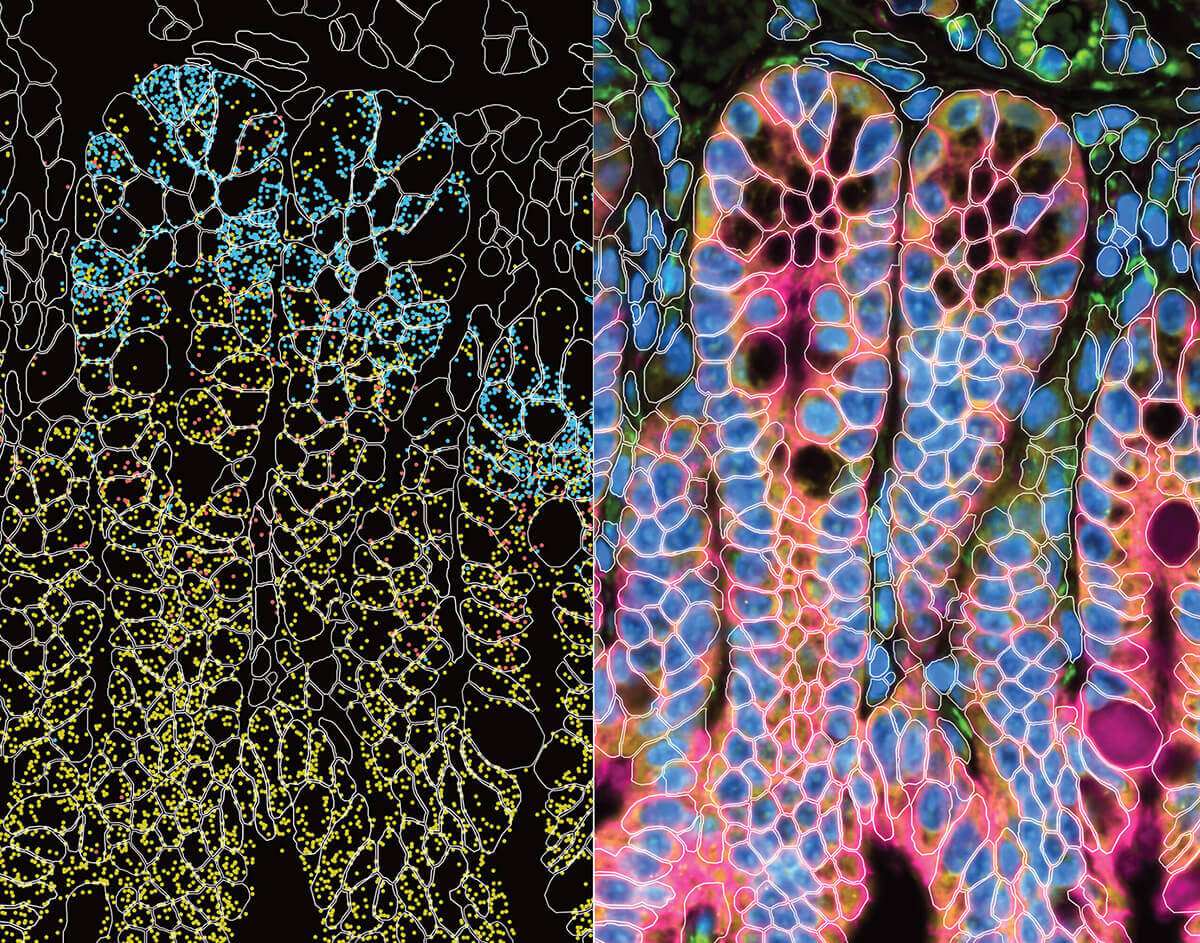 Xenium spatial transcriptomics of mouse small intestine crypts, showing individual RNA molecules and immunofluorescence staining of tuft cells that sense parasitic infection