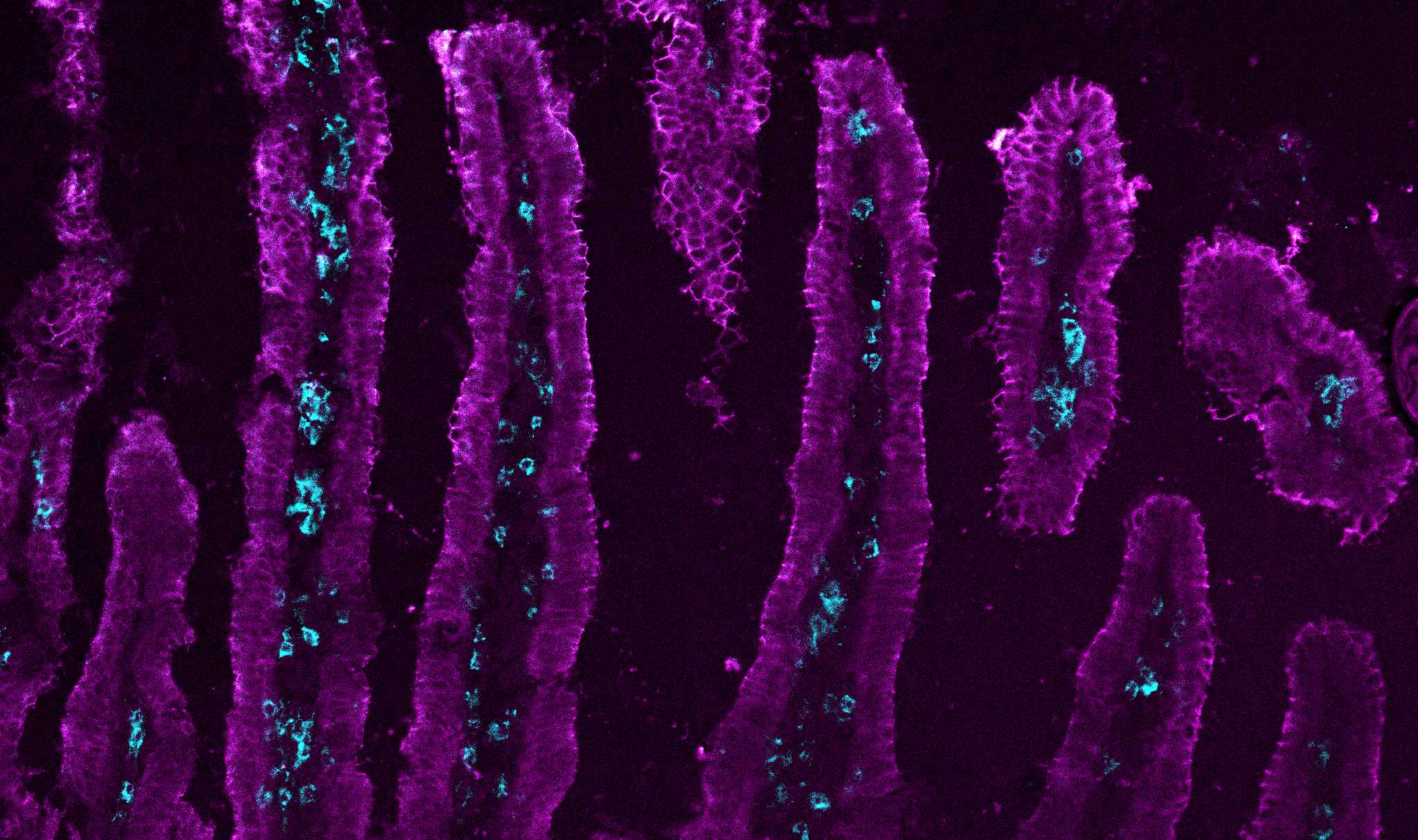Immunofluorescence of T cells in the small intestine after LCMV infection.