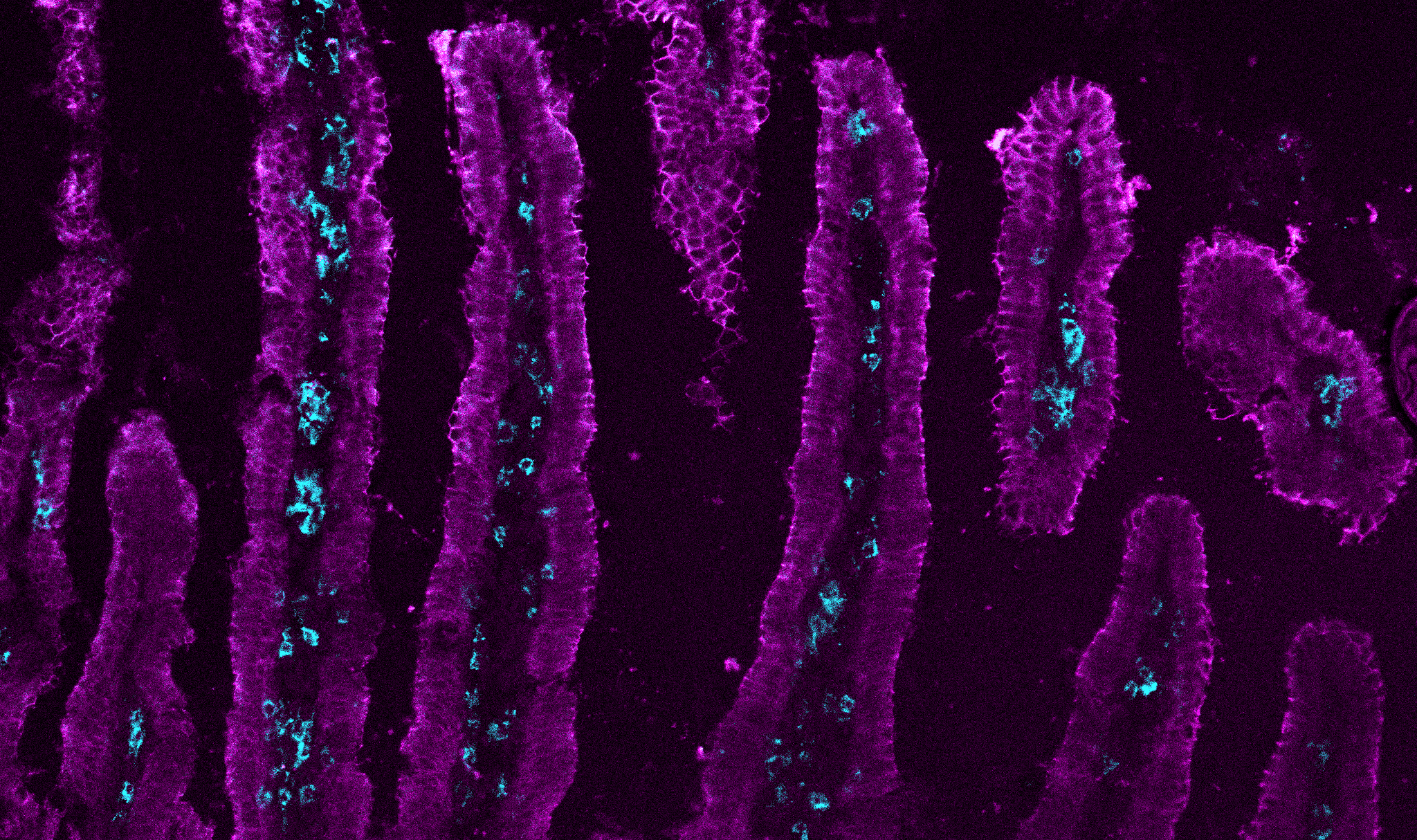 Immunofluorescence of T cells in the small intestine after LCMV infection.