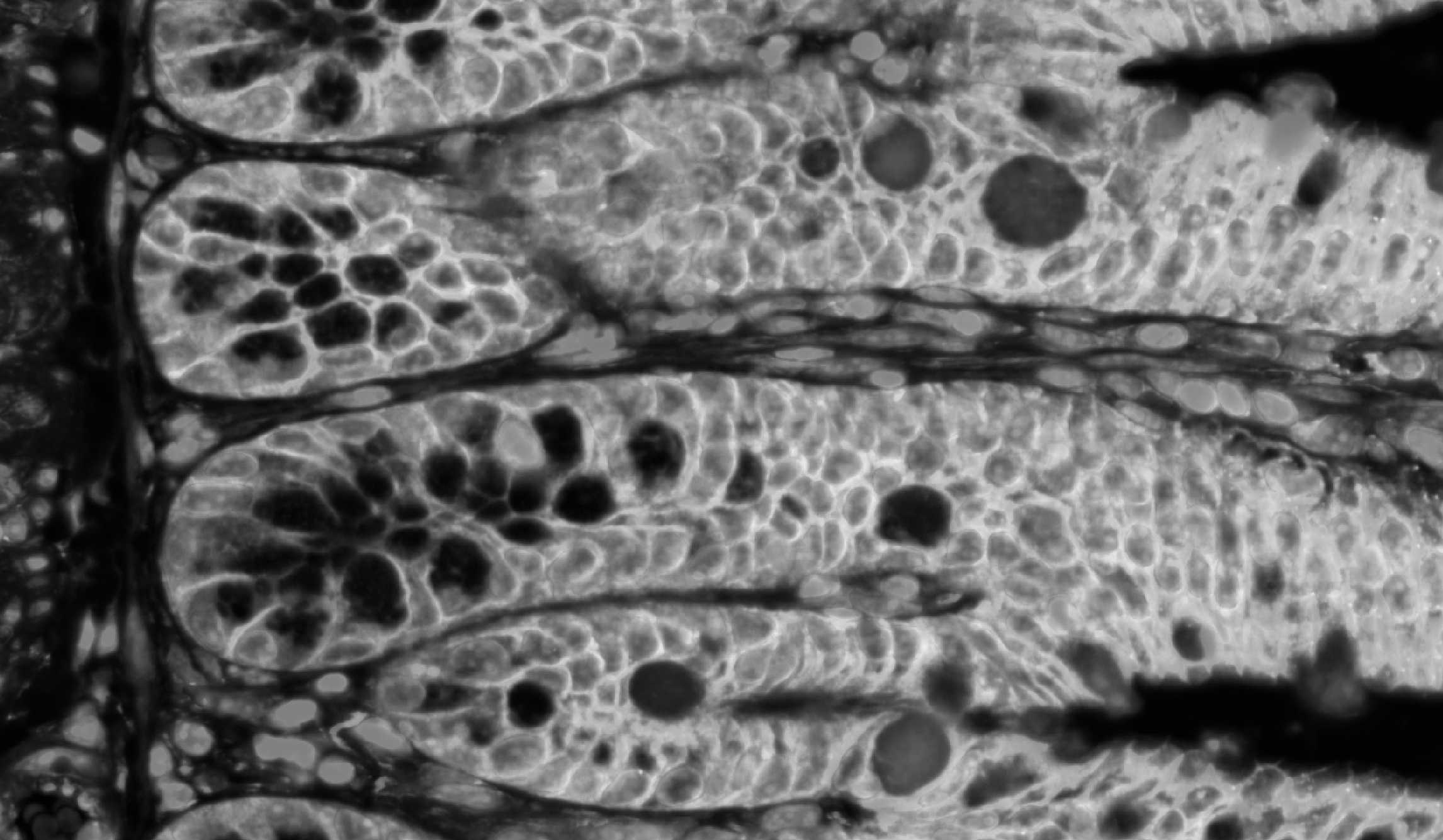 Fluoresence image of a villus