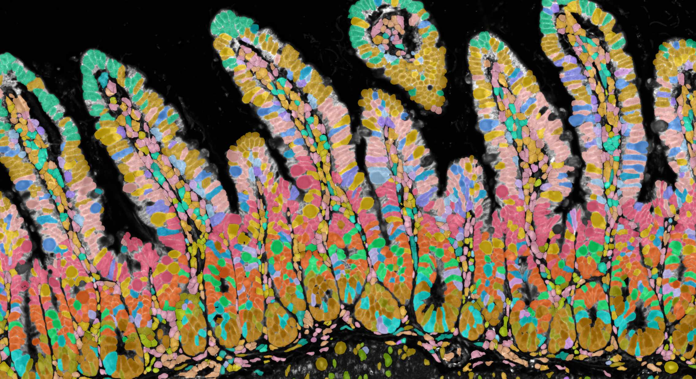 Xenium image showing the boundary staining
