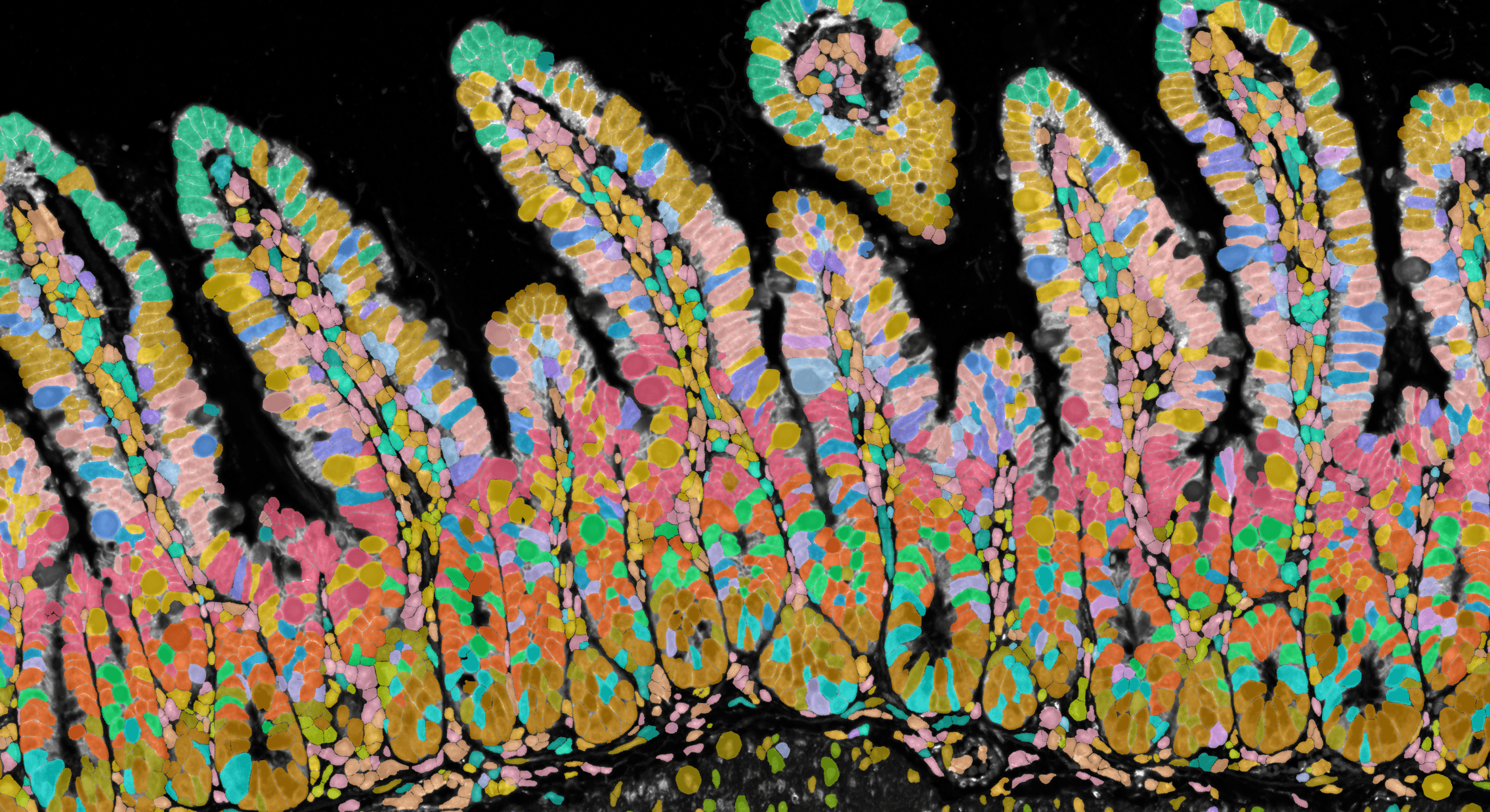 Xenium image showing the boundary staining